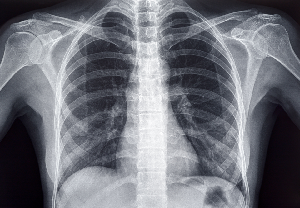 Xray imaging at Central Medical Centre